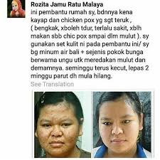 Royal v tiada bahan pengawet. Bio Beauty Essence Bedak Sejuk Kecantikan Jamu Ratu Malaya Shopee Malaysia