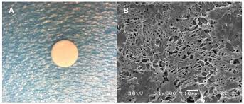 Image result for Oreophyton