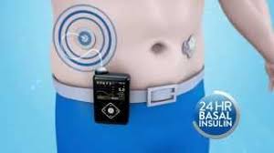 Insulin infusion pumps have been reported to cost about $4500, with additional costs for supplies exceeding $1500 per person per year. Medtronic Minimed How Does The Minimed 640g Insulin Pump Work Youtube