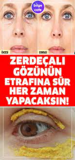Zerdecali Gozlerinin Etrafina Surenler Bir Daha Vazgecmiyor Zerdecal Cilt Bakimi Dogal Cilt Bakimi