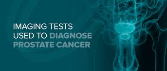 Prostate cancer has many risk factors. Imaging Tests Used To Diagnose Prostate Cancer Envision Radiology