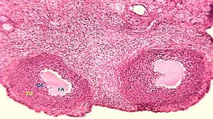 Image result for Phyllanthus muellerianus