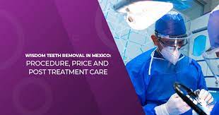 That includes sedation, follow up checkups and removal of surgical sutures. Wisdom Teeth Removal In Mexico Procedure Price And Post Treatment Care