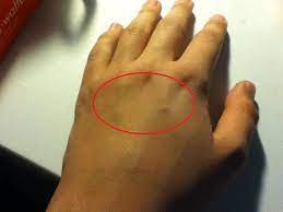 Was Ist Das Fur Ein Komisches Reibendes Gefuhl In Der Linken Hand Gesundheit Korper Schmerzen