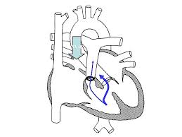 8 years ago8 years ago. Penyakit Jantung Dan Kegawatannya Pada Bayi Dan Anak
