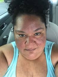 I'm doing degree in Nutrition/patisserie ￼ and in my assessment I wanted to  write about how nutritious effect our body Because my body so sensitive I  thought I do experiment