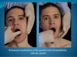 Image result for Submandibular Exam