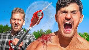 Snapped 100+ Times by Giant RUBBER BANDS in the SAME SPOT Experiment *Crazy  Bruising*