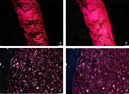 Image result for Polarized Microscopy