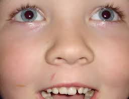 Look .. my tooth is loose!