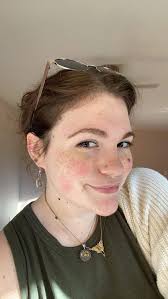 Weight Loss Progress After Bariatric Surgery