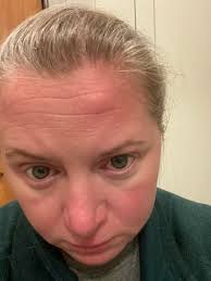 Do you bump your head often?