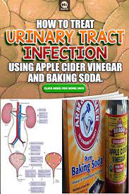 How To Treat Urinary Tract Infection Using Apple Cider Vinegar And Baking Soda Apple Cider Vinegar Remedies Bladder Infection Remedies Baking Soda For Uti