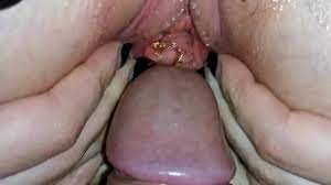 XNXX.com