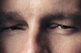 On m'a marche sur le pied. Enflure Des Paupieres Causes Et Traitements All About Vision