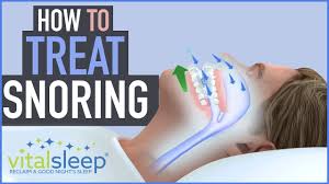 How To Treat Snoring How To Stop Snoring How To Treat Snoring Youtube
