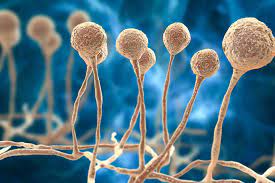 Also called mucormycosis, black fungus is, as the name suggests is a fungal disease that is commonly being observed in. The Black Fungus Epidemic Hitting Covid 19 Patients In India Gavi The Vaccine Alliance