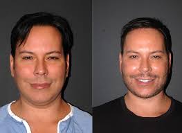 Andrew Jacono, MD-The New York Center for Facial Plastic and Laser  Surgery...