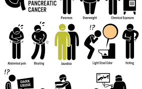 Genetics, obesity, tobacco use, sedentary lifestyle, diabetes, pancreatitis, and a fatty diet are risk factors. Pancreatic Cancer Symptoms And Treatment Cyberknife Miami