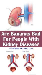 Polycystic Kidney Disease Treats Polycystic Kidney Disease Kidney Disease Causes Of Kidney Disease