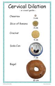 cervical dilation chart visual gude ob nursing