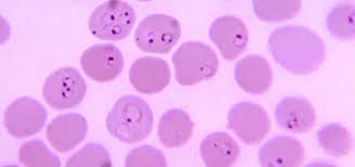 Malaria is a potentially life‑threatening tropical disease caused by plasmodium parasites, which are transmitted through the bite of an infected female anopheles mosquito. Parasites That Cause Asymptomatic Malaria Differ In Gene Expression As Compared To Febrile Infections But Seem To Be Equally Transmissible News Isglobal