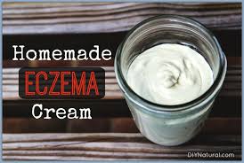homemade eczema cream a natural
