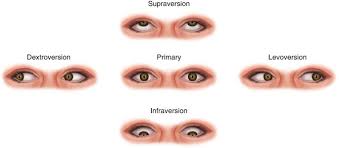 Image result for Extraocular Movement