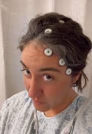 Acoustic Neuroma Journey