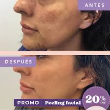 Consultorio Dermatológico Loayza