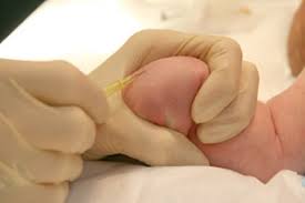 Image result for Difficult Intravenous Access in Children