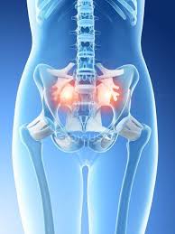 Hip anterior view, the hip is the synovial joint that connects the femur to the iliac bone. Abstract Female Hips Showing Lower Back Pain Conceptual Illustration Medical Unhealthy Stock Photo 308621512
