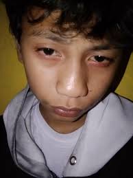 Denis Auer in personen