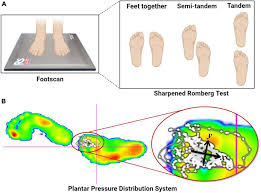 Image result for Romberg Test