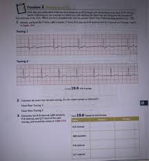 How to calculate heart rate from ecg. Procedure 1 Correlating Points On An Ecg With Electrical Events Of The Heart Let S Start By Homeworklib