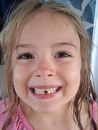 Charlotte has officially lost her first tooth 😅😜😎