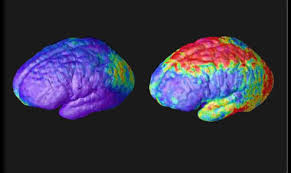 Major symptoms include hallucinations (typically hearing voices), delusions. Ù…Ø§ Ù…Ø¹Ù†Ù‰ ÙƒÙ„Ù…Ø© Medical Science Ø¨Ø§Ù„Ø¹Ø±Ø¨ÙŠ
