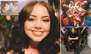 Former conjoined twin, 22, becomes a TikTok star