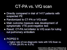 advances in pulmonary embolism imaging ppt video online