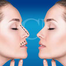 After completing her fellowship with one of mexico's world renowned surgeons, dr. Home Cammel Plastic Surgery