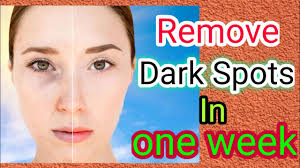There are over the counter products and there are also expensive cosmetic. In 7 Days L Remove Dark Spots Acne Scars Pigmentation L 100 Natural Remedy Ll Youtube