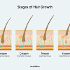 As your hair grows, individual strands randomly cycle through four, ongoing phases: Https Encrypted Tbn0 Gstatic Com Images Q Tbn And9gctv1yyqhid1 Jbgoe L1j2esxhw8kvxyjecydt7zwitlbamby08 Usqp Cau