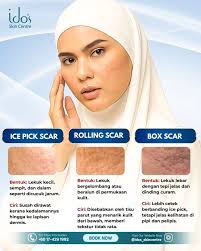 ✨ Selamat Tinggal Parut, Hai Kulit Licin! ✨ Parut jerawat seperti Ice Pick,  Rolling dan Box Scars boleh menyebabkan kulit muka kita kelihatan tak rata  dan berlekuk. Jangan risau, rawatan Fractional Laser