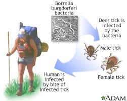 Image result for infected tick bite
