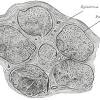 Nerve injury stratification on imaging by using sunderland classification has not been scientifically studied before. 1