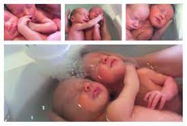 Video De Gemelos Recien Nacidos Conmueve Al Mundo Fotos Y Video Cubadebate