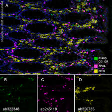 Anti-CD8 alpha antibody [EPR22483-288] 20 ul size (ab245118)