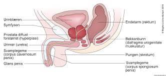 Uretritis (infektiøs inflammation i urinrøret). Urinretensjon Og Urinrorskateter Nhi No