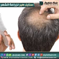مظهر شعرك رأسك يسبب لك الإحراج في كثير من الأحيان نقدم لك أفضل زراعة للشعر في مركز ستايل هير في تركيا تحت إشراف أفضل الأطباء و خ Stylish Hair Stylish Hair
