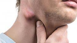 Semoga penjelasan di atas membantu anda mengetahui lebih baik lagi tentang penyebab, gejala, dan pengobatan kanker kelenjar getah bening. 4 Penyebab Kelenjar Getah Bening Membengkak Yang Tak Boleh Anda Abaikan Tribunnews Com Mobile